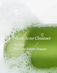 CELIMAX - Noni Acne Cleanser - Nettoyant 155 ml
